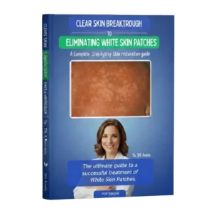 Skin Patch Remover Guide